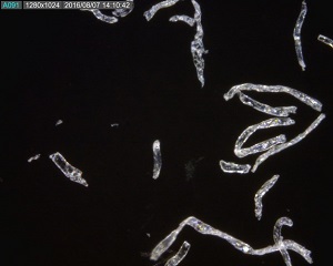 顕微鏡で拡大された繊維くず
